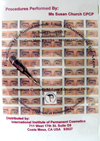 Eyebrow Hair Simulation and Lash Enhancement for Men w/ The Rotary Machine